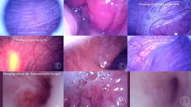 Compilation: Endoscope in my Dick, Ass and Bladder
